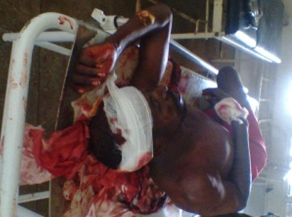Southern Kaduna killings: NEMA confirms 204 killed, Catholic Church puts the figure at 808 at Dec