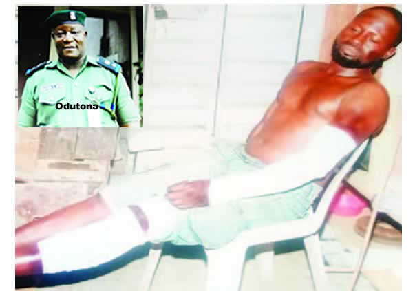 Power-drunk DPO breaks Lagos carpenter’s hand, leg