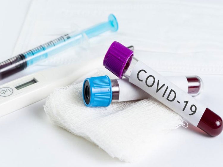 Nigeria reports 313 more COVID-19 cases