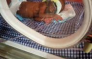 Lagos hospital successfully manages 700g pre-term baby