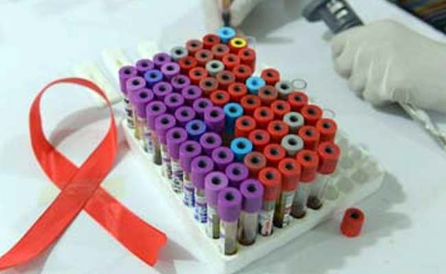 HIV becoming less virulent, its aibility to cause AIDS slowing: STUDY