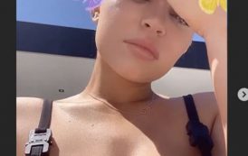 Kylie Jenner shows off the stretch marks on her breasts and fans loved it