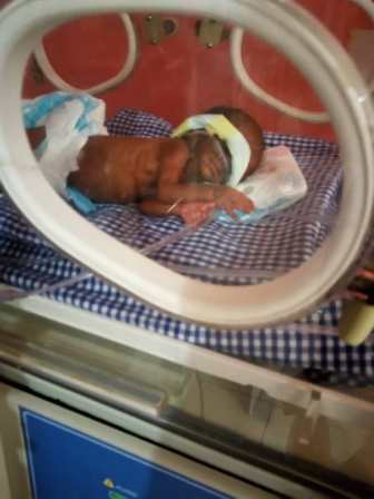 Lagos hospital successfully manages 700g pre-term baby