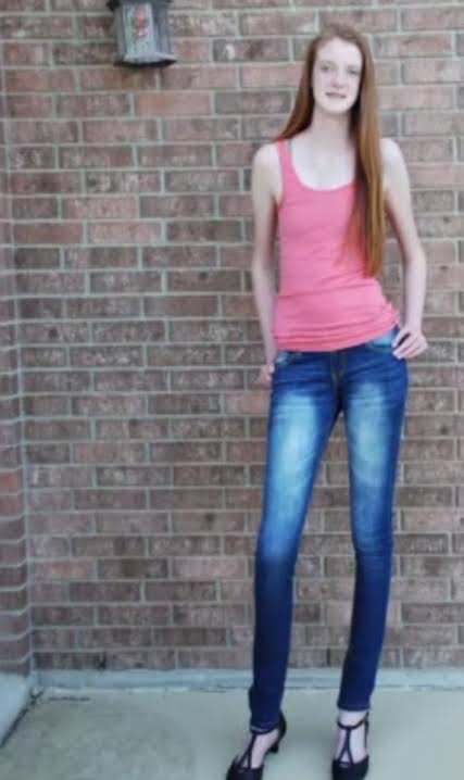 Guinness World Records says teen girl has the world’s longest legs