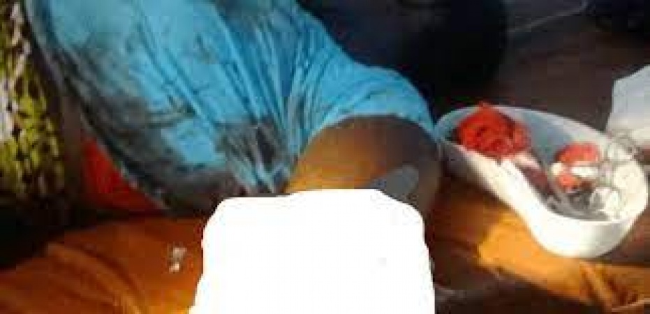 Man cuts off girlfriend’s hand over alleged infidelity